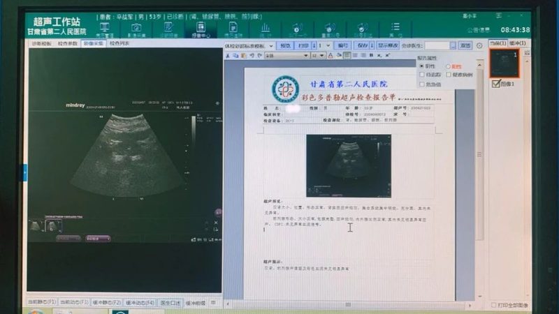 入职体检套餐批发，如何选择更合适？**